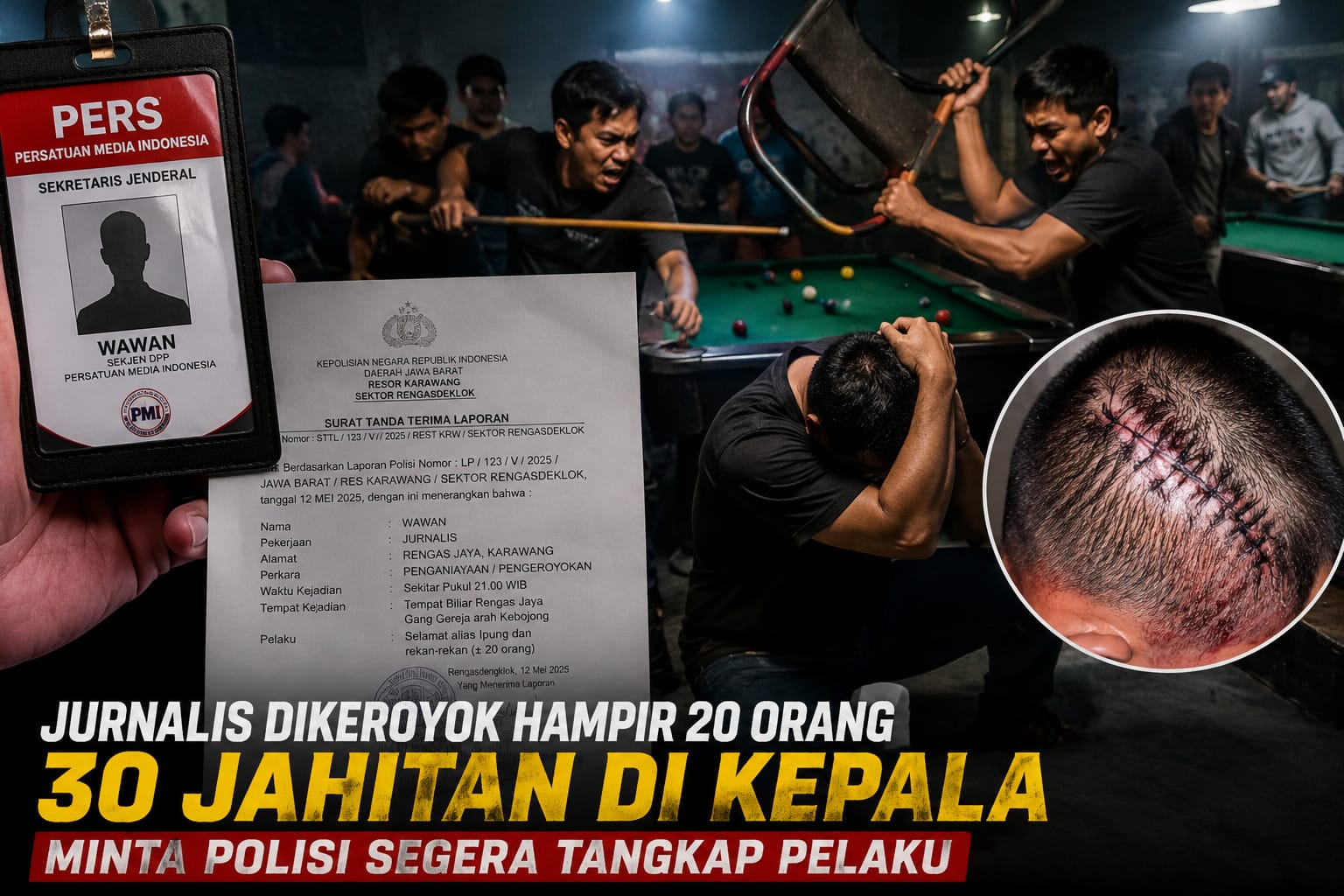 Jurnalis BNN ( H.wawan  ) Mengaku Dikeroyok Hampir 20 Orang, Kepala 30 Jahitan: Polisi Rengasdengklok Diminta Segera Bertindak